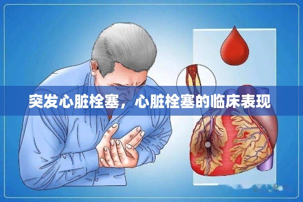 突发心脏栓塞,心脏栓塞的临床表现