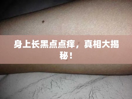 身上长黑点点痒，真相大揭秘！